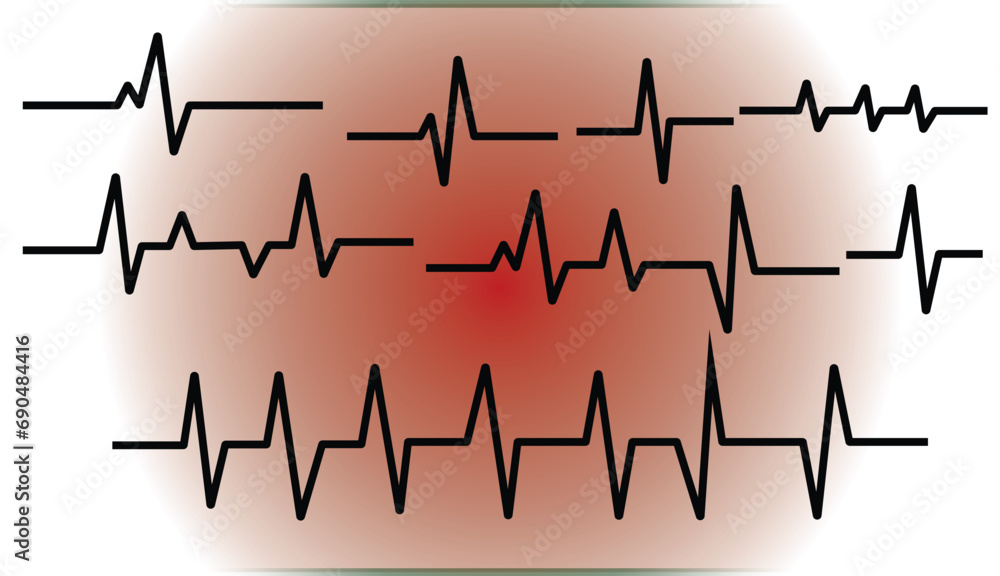 heart beat cardiogram set vector. heartbeat set