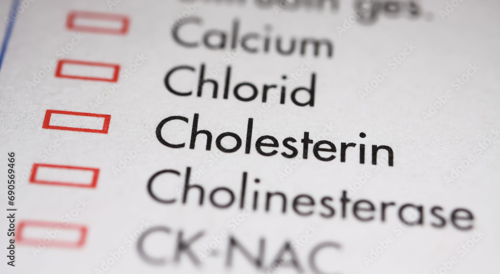 Viersen, Germany - May 9. 2023: Closeup of lab sheet for medical diagnostics cholesterol blood test Viersen, Germany - May 9. 2023: Closeup of lab sheet for medical diagnostics cholesterol blood test