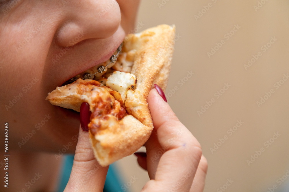 Closeup of woman with dental braces eating slice of pizza Closeup of woman with dental braces eating slice of pizza