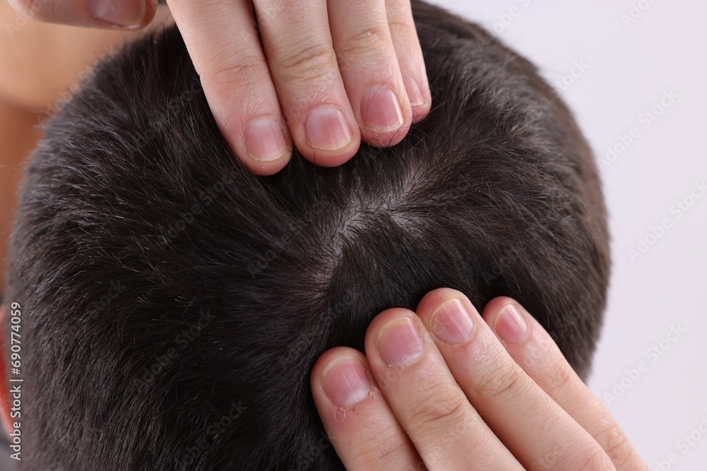Fototapeta premium Man examining his hair and scalp on white background, closeup