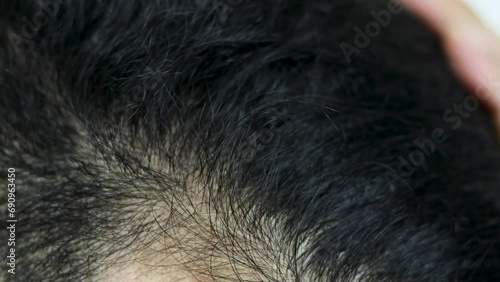 Close Up Young people have problems with hair loss, dryness, dullness, split ends and damage. photo