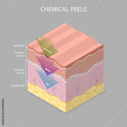 3D Isometric Flat Vector Illustration of Skin Chemical Peel, Beauty Aesthetic Treatment