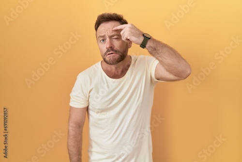 Middle age man with beard standing over yellow background pointing unhappy to pimple on forehead, ugly infection of blackhead. acne and skin problem photo