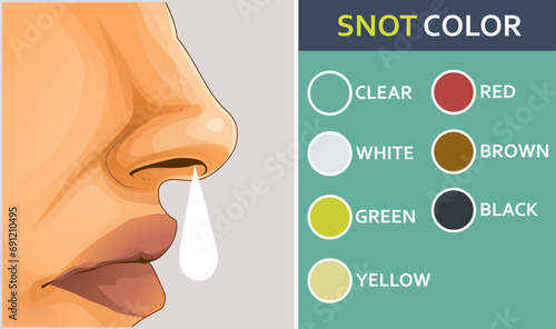 Human nose in profile. Nasal discharge. Color of nasal discharge. Healthcare illustration. Vector illustration.