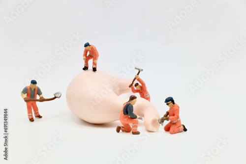 miniature figurines of men at work working on a huge human stomach photo