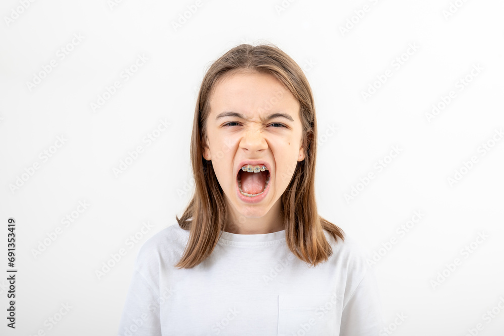 A teenage girl with braces screams with her mouth wide open. A teenage girl with braces screams with her mouth wide open.