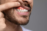 Man showing inflamed gum on grey background, closeup. Space for text