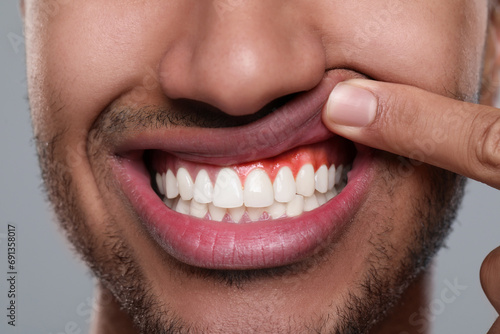 Man showing inflamed gum on grey background  closeup