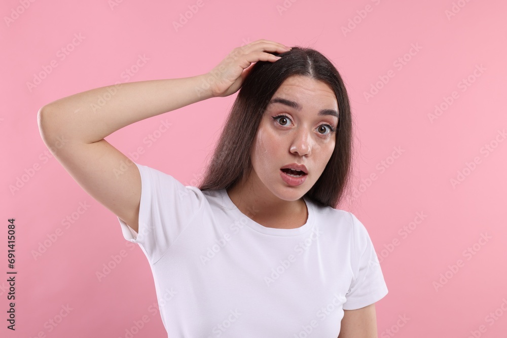 Emotional woman suffering from dandruff problem on pink background Emotional woman suffering from dandruff problem on pink background