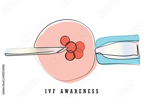 line art vector of IVF procedure. cell is holding by a pipet and a needle