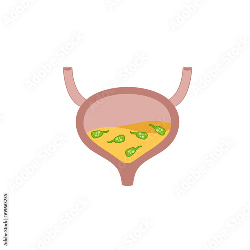 Virus in the bladder. Infection and inflammation of urine and internal organ. Green virus and bacteria. Medical problem and illustration isolated on white background