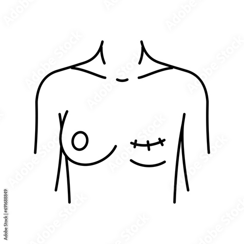 mastectomy surgery surgery line icon vector. mastectomy surgery surgery sign. isolated contour symbol black illustration photo