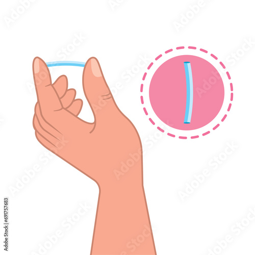 contraceptive implant design