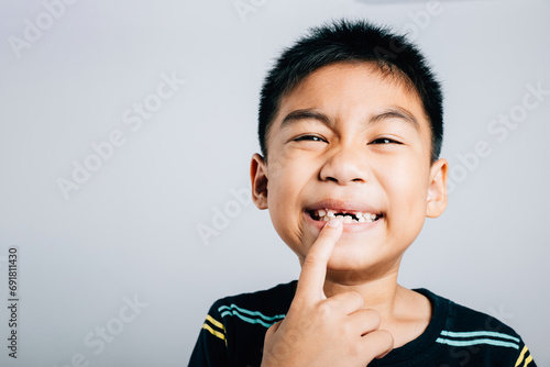 Little boy wide smile reveals gap of growing molar. At six years old losing baby teeth marks delightful stage in dental growth and care. joyous portrait. teeth new gap dentist problems photo