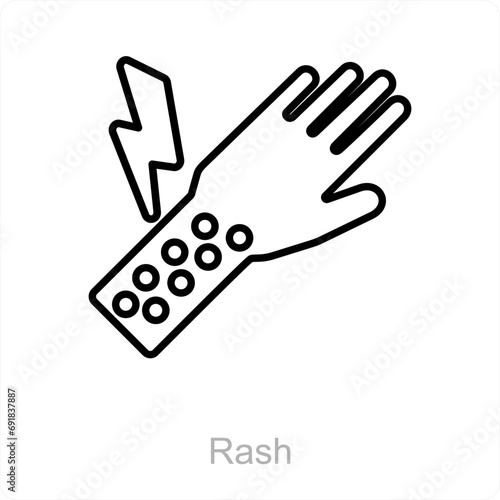 Rash