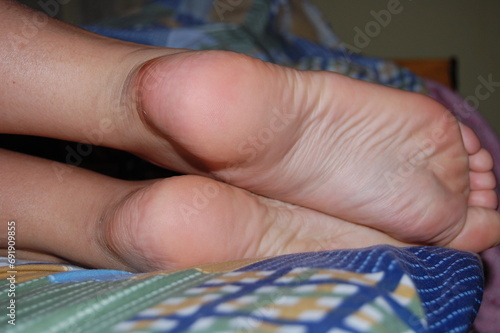 Close-up of woman's bare feet on gridded sheet.