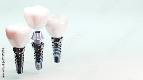 Fototapeta Naklejka Na Ścianę i Meble -  3D rendering of tooth implants with ceramic crowns on color background, Modern dental surgery concept