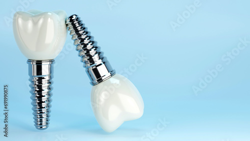 Fototapeta Naklejka Na Ścianę i Meble -  3D rendering of dental implant structure, medical teeth implant, design of dentistry, implant screw, healthcare, dentist and orthodontist treatment, Dental implants surgery concept