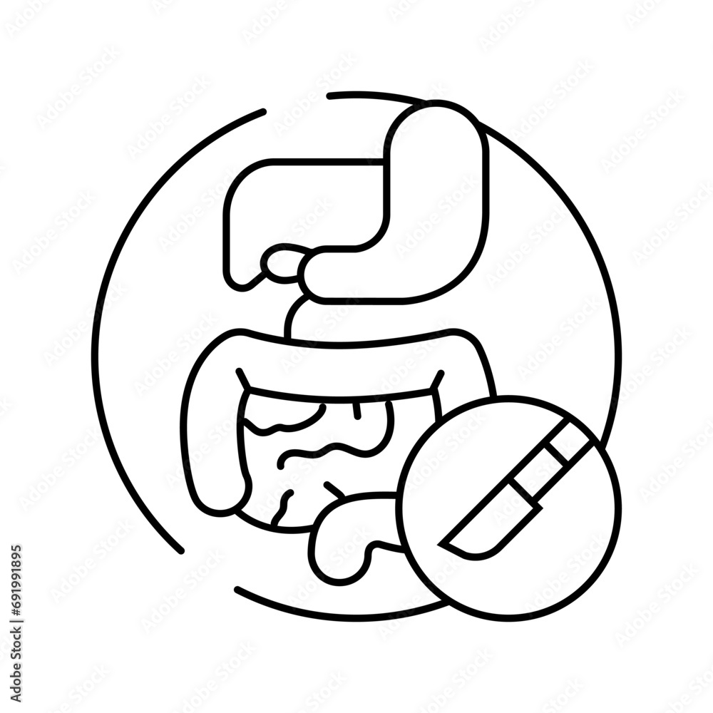 gastrointestinal surgery line icon vector. gastrointestinal surgery sign. isolated contour symbol black illustration gastrointestinal surgery line icon vector. gastrointestinal surgery sign. isolated contour symbol black illustration