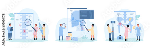 Orthopedic diseases set vector illustration. Cartoon tiny people with magnifying glass study spine, hip joint and neck in medical anatomy diagram for diagnosis, treatment and rehabilitation of patient
