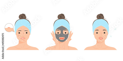 Woman with acne skin problem. Before and after acne. Woman making skin care, application of masks. Skin Care Routine, Hygiene and Moisturizing Concept. Vector flat illustration.