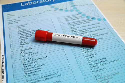 Liver Function Test. Tube with blood sample and laboratory form on table