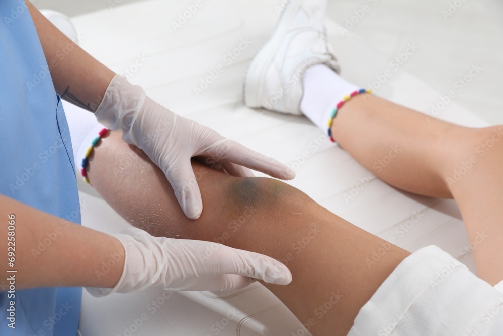Doctor examining little child's bruised knee in hospital, closeup Doctor examining little child's bruised knee in hospital, closeup