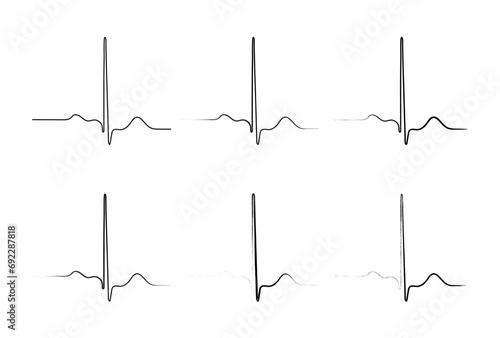 Ventricular repolarization, Cardiac cycle, ECG of heart in normal sinus rhythm, QT interval of ECG. photo