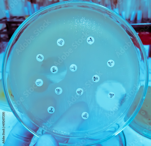 Antimicrobial susceptibility testing in petri dish showing Imipenem is sensitive and other antibiotics are resistance for this organism. photo