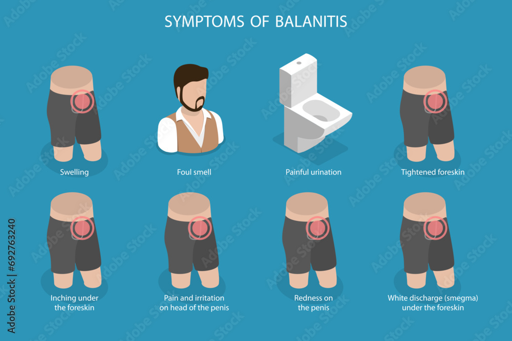 3D Isometric Flat Vector Illustration of Symptoms Of Balanitis ...