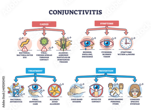 Conjunctivitis or pink eye causes, symptoms, prevention and treatment outline diagram. Labeled educational scheme with eyes inflammation and medical condition explanation vector illustration.