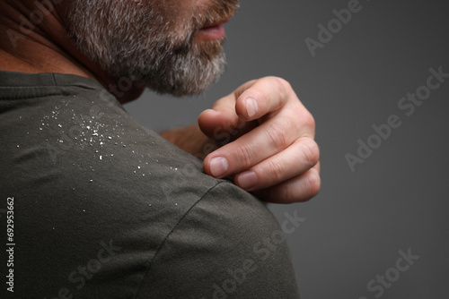 Bearded man brushing dandruff off his t-shirt on grey background, closeup. Space for text photo