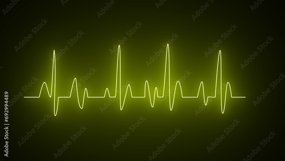 Heartbeat line, Pulse trace. Yellow glowing neon heart pulse graphic illustration. Neon heartbeat on black isolated background. ECG diagram.