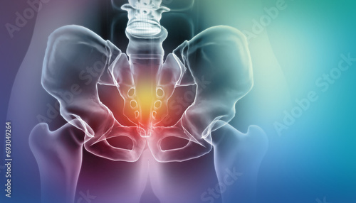 Painful Hip skeleton, x-ray view, Medical concept. 3d illustration