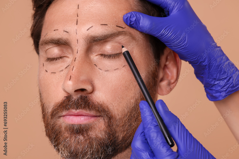 Doctor drawing marks on man's face for cosmetic surgery operation against beige background, closeup Doctor drawing marks on man's face for cosmetic surgery operation against beige background, closeup
