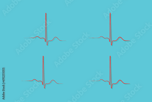 Ventricular repolarization, Cardiac cycle, ECG of heart in normal sinus rhythm, QT interval of ECG.