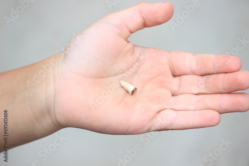 The child lost a tooth. Selective focus.Concept baby tooth