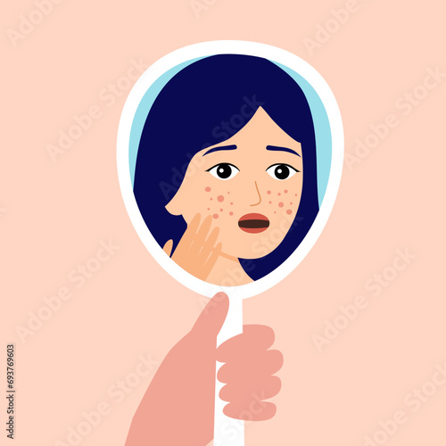 Young woman hand mirror worrying about her acne on face in flat design. Pimple problem on female skin.