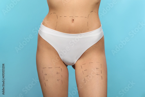 Slim woman with markings on body before cosmetic surgery operation on light blue background, closeup