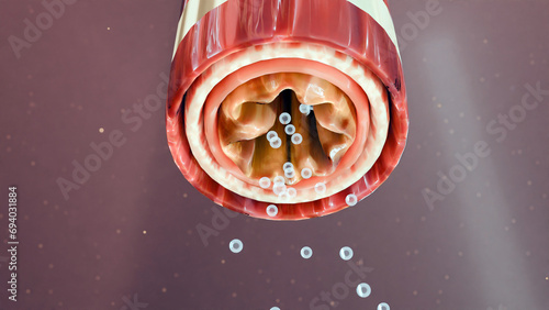 Tableau sur toile Asthma Symptoms, Treatment, Bronchiole, 3d render