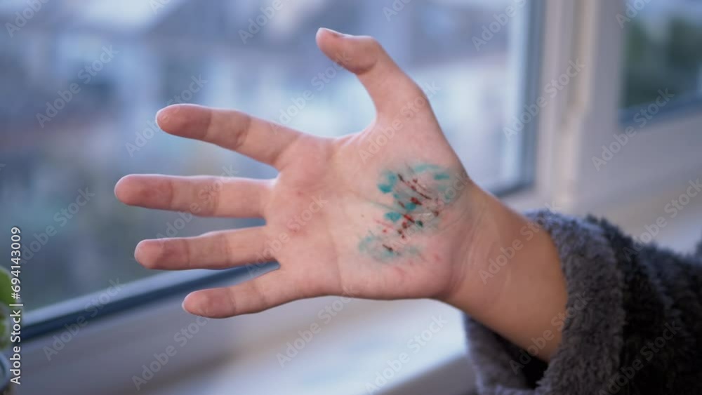 Vidéo Stock Teenager Showing a Wound on Hand with Scratches, Blood ...