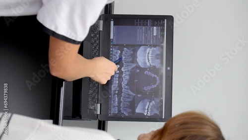 Doctor showing X-ray of patient model of dental implant in clinic on laptop screen, close-up. Consult and make decision on treatment or placement of implant. Vertical video photo