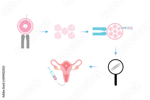 Preimplantation Genetic Diagnosis (PGD) Scientific Design. Vector Illustration. photo