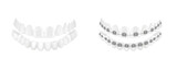 3D Teeth With And Without Orthodontic Braces