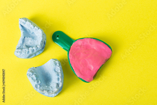 Dental spoon with alginate plastic mass for taking an impression of the dental jaw on a yellow background. Blue plaster dental jaw on a yellow background. Orthodontics in dentistry