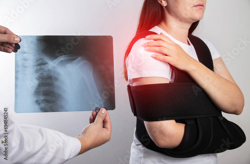 Obraz na płótnie The doctor holds in his hand a medical x-ray of a dislocated humerus and a fractured collarbone against the background of a girl patient whose shoulder hurts