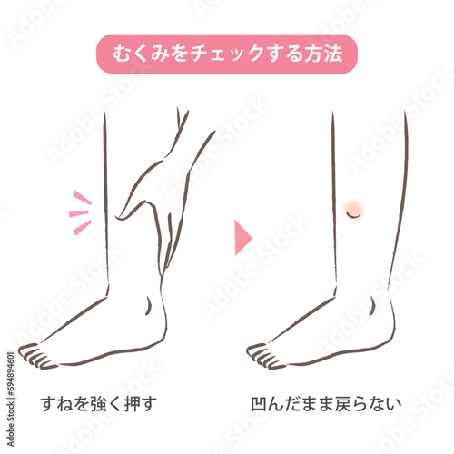 足のむくみをセルフチェックする方法のイラスト photo