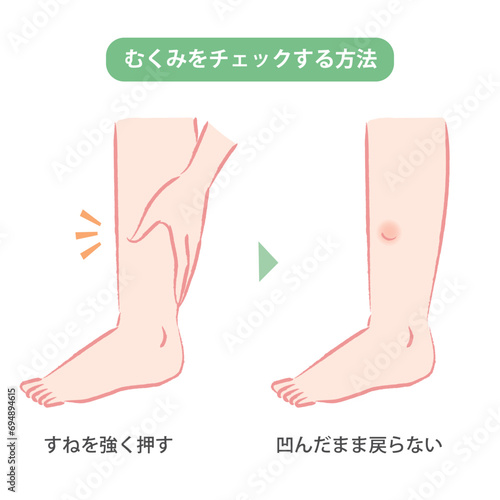 足のむくみをセルフチェックする方法のイラスト