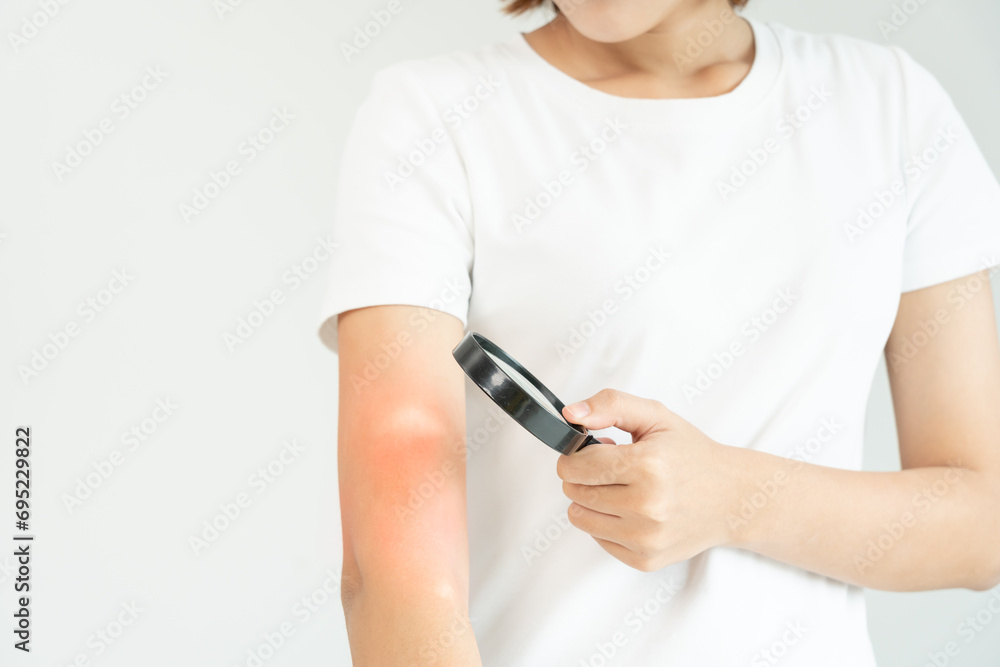 skin problem and beauty. asian woman use magnifying glass look itchy skin from skin allergic, shocked, steroid allergy, sensitive, chemical allergy, rash, insect bites, Seborrheic Dermatitis. skin problem and beauty. asian woman use magnifying glass look itchy skin from skin allergic, shocked, steroid allergy, sensitive, chemical allergy, rash, insect bites, Seborrheic Dermatitis.