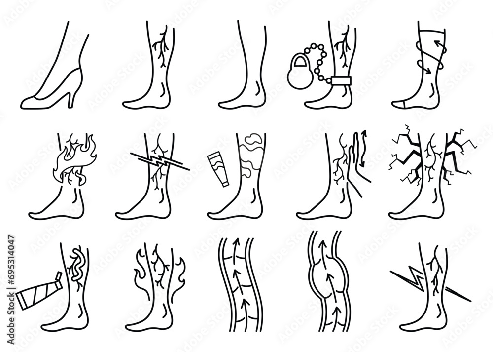 Varicose treatment icons set in coloring style. Violation of circulatory system. Vascular disease diagnostic. Venous insufficiency medical disease. Vector illustration - obrazy, fototapety, plakaty 